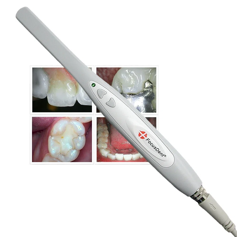 MD740 USB Intraorale Kamera - Intraoralkamera - Zahnarztkamera - USB Plug & Play, 6 LED, 1.3 Mega Pixels - Bildbearbeitungssoftware enthalten